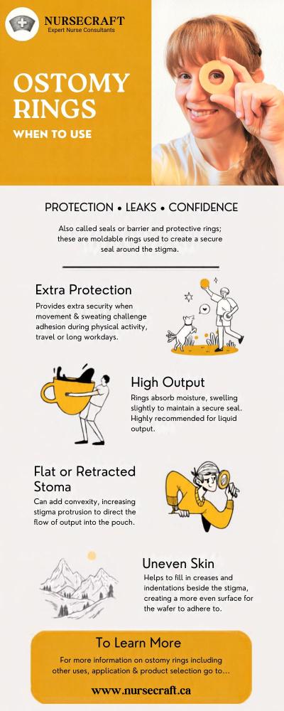 NurseCraft infographic: When to Use an Ostomy Ring &mdash; extra protection during activity, high output absorption, help with a flat or retracted stoma, and filling uneven skin for a better seal