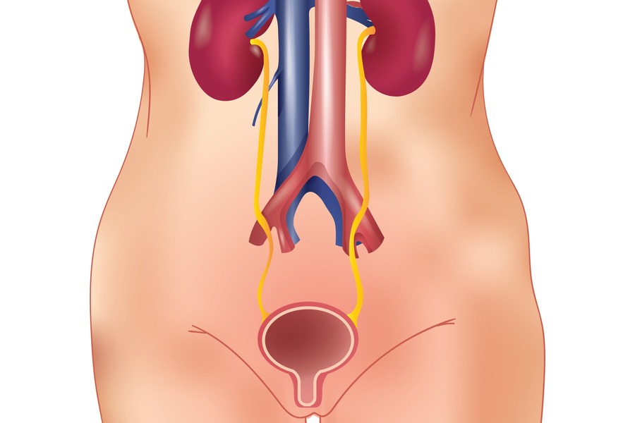 How To Make Intermittent Catheterization Less Painful