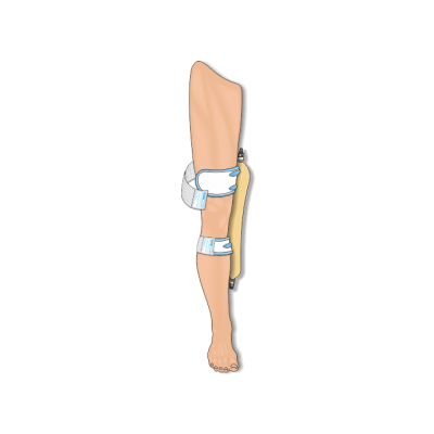 Urocare 6350 - Urocare Fabric Leg Strap Kit, Large (No. 6344 & No. 6345), KIT