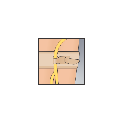 Urocare 6312 - Catheter/Drainage Tube Strap, Large 22" (46cm), Pkg 1