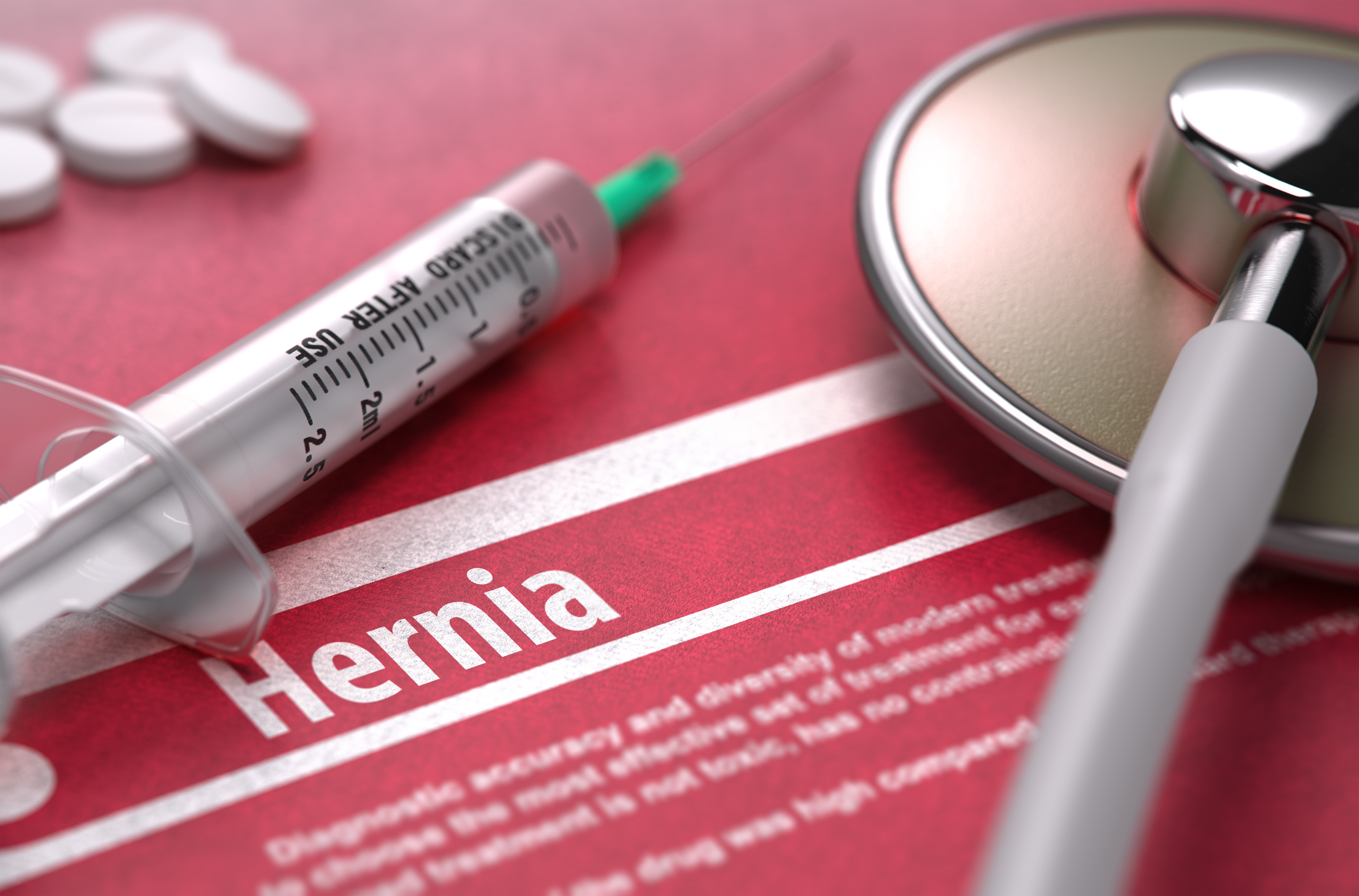 Spigelian Hernia - Causes, Symptoms, Treatment & Repair